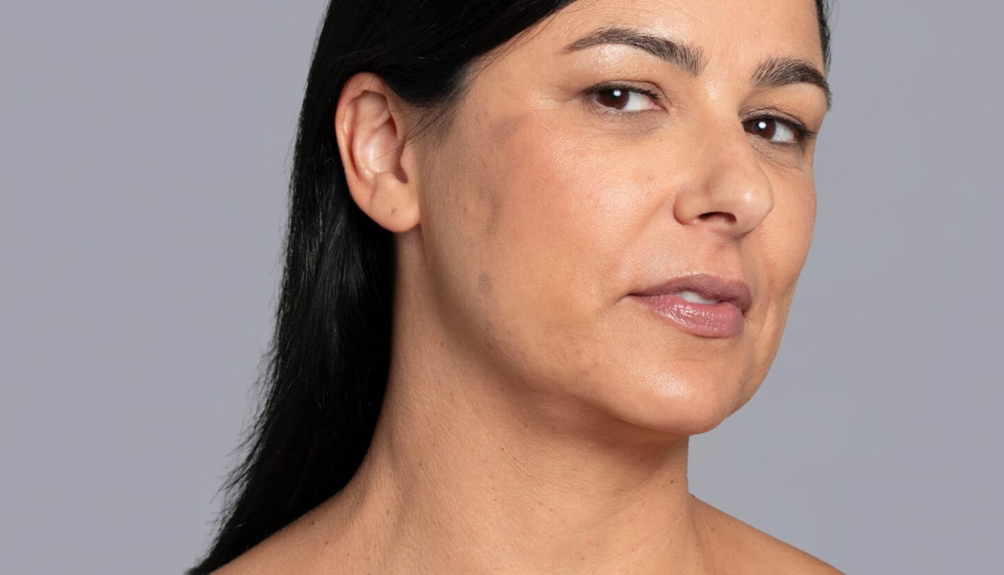 Brightening & Pigmentation Control Protocol