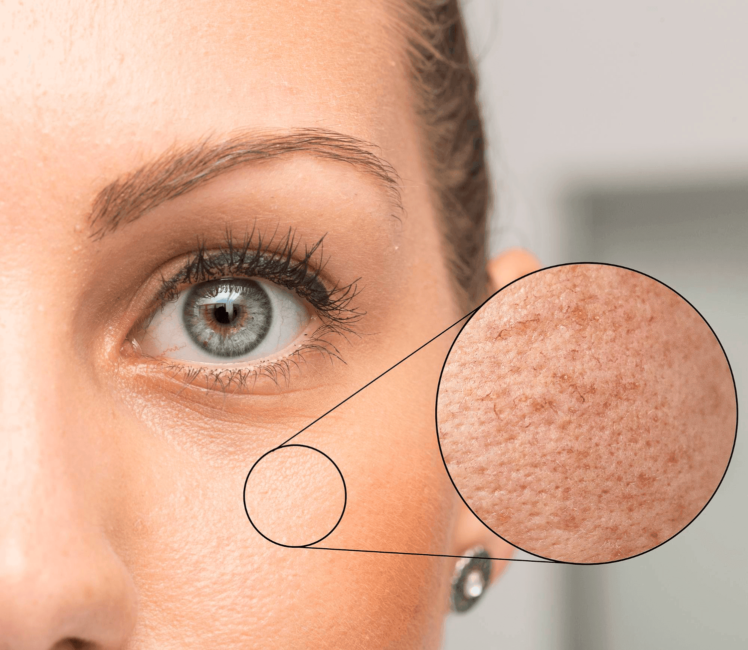 Anti-Aging Aesthetic Solutions