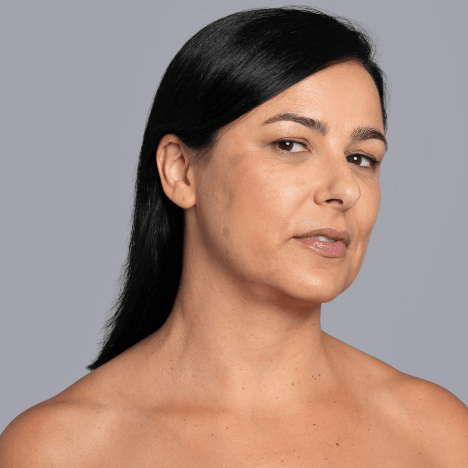 Mesotherapy Skin Quality Protocol